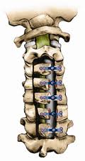 Spine Laminoplasty in India